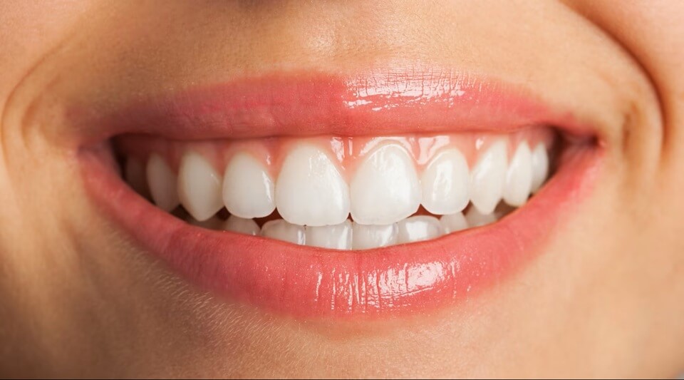 Teeth Whitening Treatment